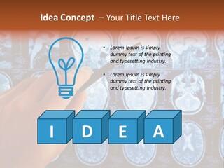 A Person Holding A Pen In Front Of Mri Images PowerPoint Template