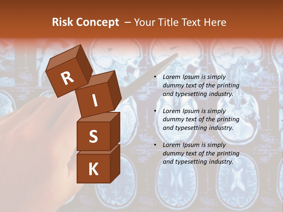 A Person Holding A Pen In Front Of Mri Images PowerPoint Template