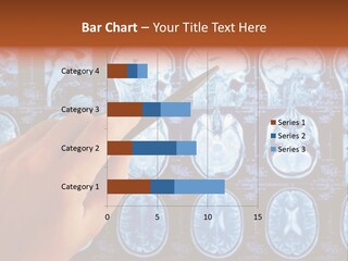 A Person Holding A Pen In Front Of Mri Images PowerPoint Template