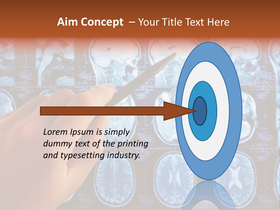 A Person Holding A Pen In Front Of Mri Images PowerPoint Template