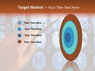 A Person Holding A Pen In Front Of Mri Images PowerPoint Template