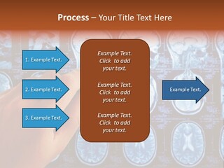 A Person Holding A Pen In Front Of Mri Images PowerPoint Template
