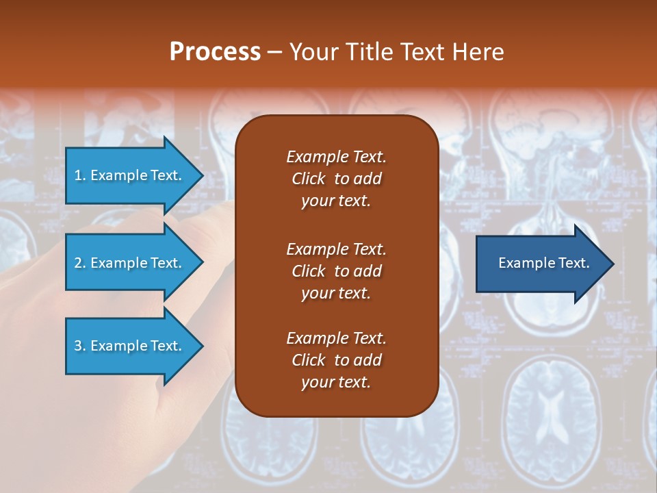 A Person Holding A Pen In Front Of Mri Images PowerPoint Template