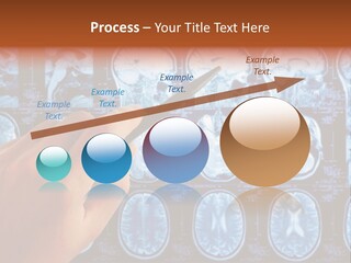 A Person Holding A Pen In Front Of Mri Images PowerPoint Template