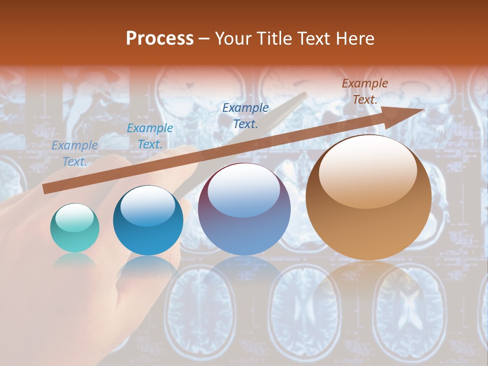 A Person Holding A Pen In Front Of Mri Images PowerPoint Template