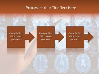 A Person Holding A Pen In Front Of Mri Images PowerPoint Template
