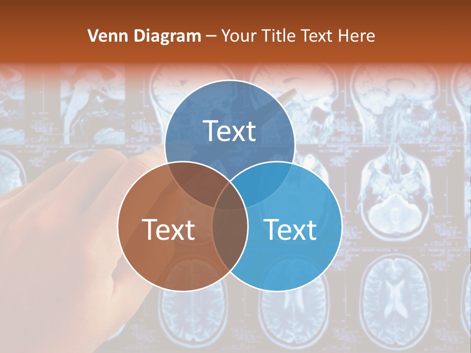 A Person Holding A Pen In Front Of Mri Images PowerPoint Template
