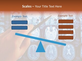A Person Holding A Pen In Front Of Mri Images PowerPoint Template