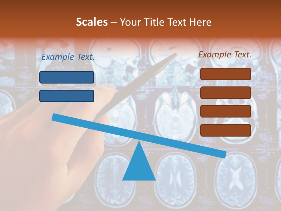 A Person Holding A Pen In Front Of Mri Images PowerPoint Template