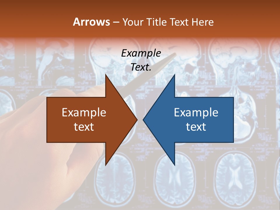 A Person Holding A Pen In Front Of Mri Images PowerPoint Template