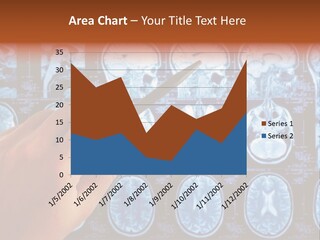 A Person Holding A Pen In Front Of Mri Images PowerPoint Template