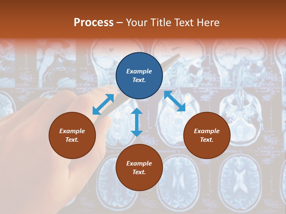 A Person Holding A Pen In Front Of Mri Images PowerPoint Template