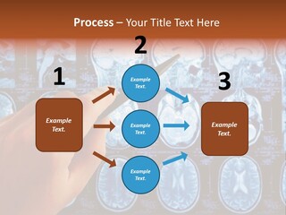 A Person Holding A Pen In Front Of Mri Images PowerPoint Template