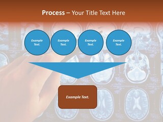 A Person Holding A Pen In Front Of Mri Images PowerPoint Template
