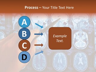 A Person Holding A Pen In Front Of Mri Images PowerPoint Template