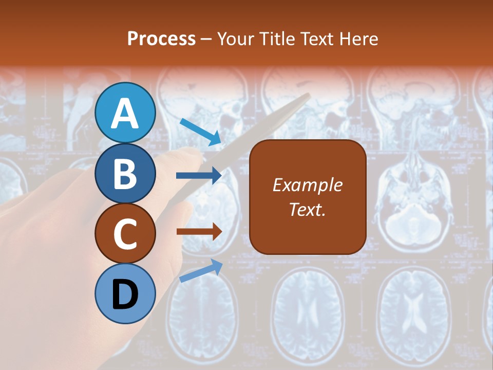 A Person Holding A Pen In Front Of Mri Images PowerPoint Template