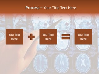 A Person Holding A Pen In Front Of Mri Images PowerPoint Template