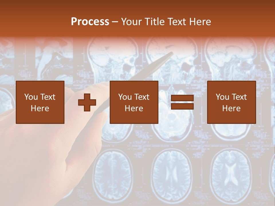 A Person Holding A Pen In Front Of Mri Images PowerPoint Template