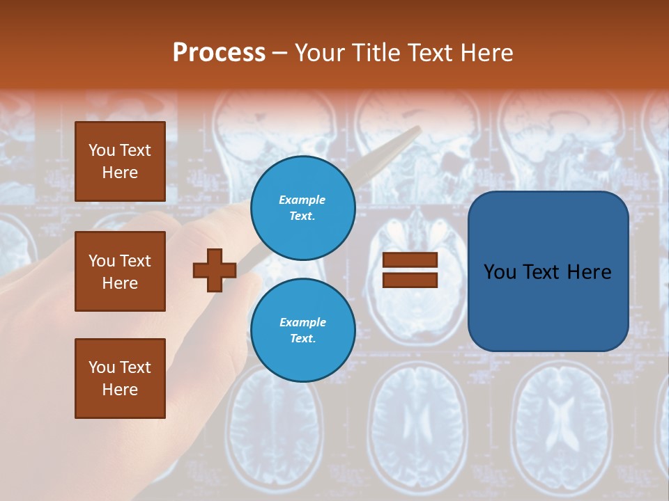A Person Holding A Pen In Front Of Mri Images PowerPoint Template