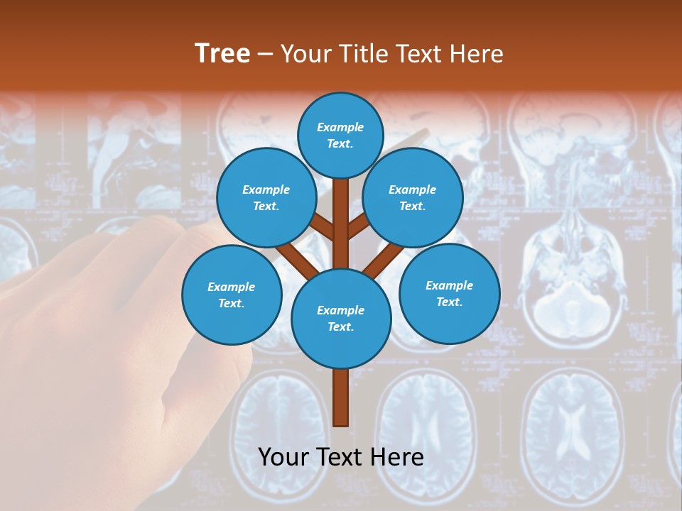 A Person Holding A Pen In Front Of Mri Images PowerPoint Template