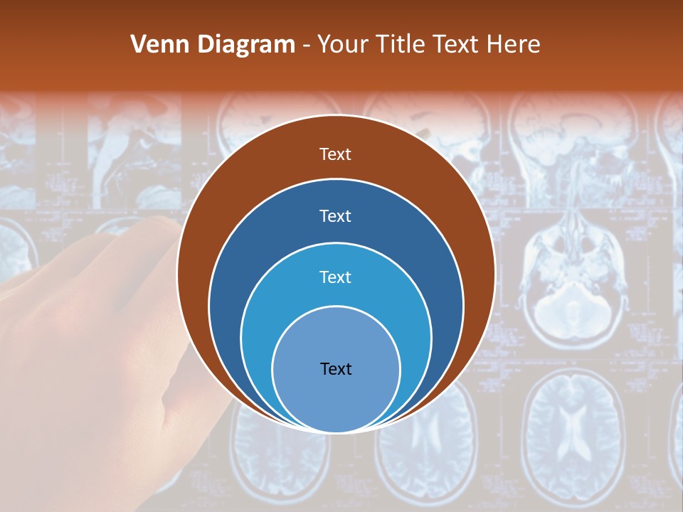 A Person Holding A Pen In Front Of Mri Images PowerPoint Template
