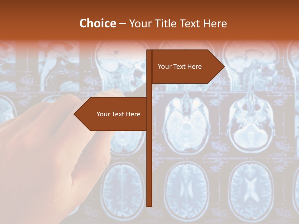 A Person Holding A Pen In Front Of Mri Images PowerPoint Template