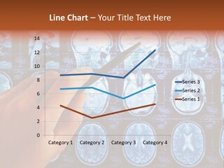 A Person Holding A Pen In Front Of Mri Images PowerPoint Template