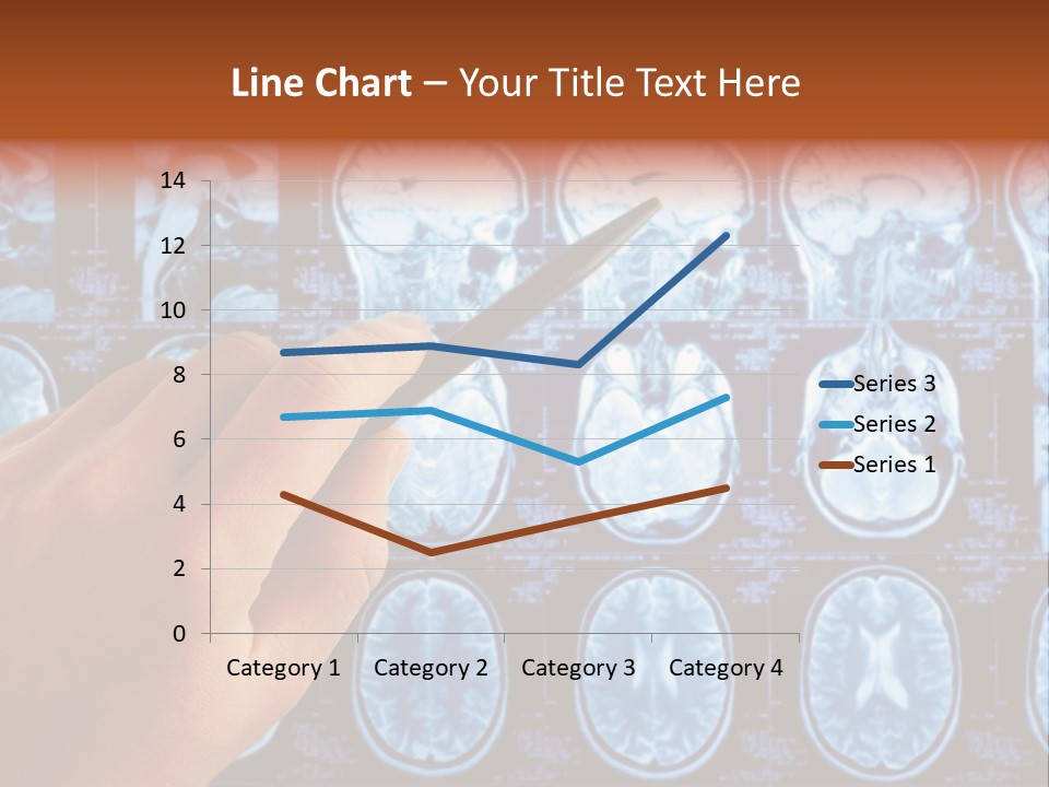A Person Holding A Pen In Front Of Mri Images PowerPoint Template