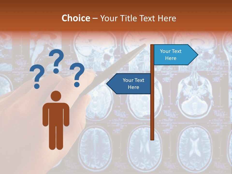 A Person Holding A Pen In Front Of Mri Images PowerPoint Template
