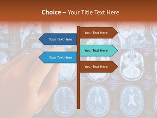 A Person Holding A Pen In Front Of Mri Images PowerPoint Template