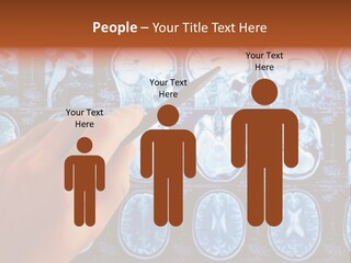 A Person Holding A Pen In Front Of Mri Images PowerPoint Template