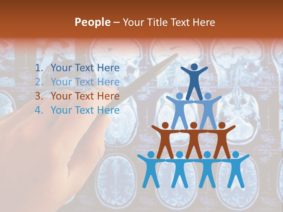 A Person Holding A Pen In Front Of Mri Images PowerPoint Template