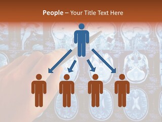 A Person Holding A Pen In Front Of Mri Images PowerPoint Template