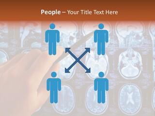 A Person Holding A Pen In Front Of Mri Images PowerPoint Template