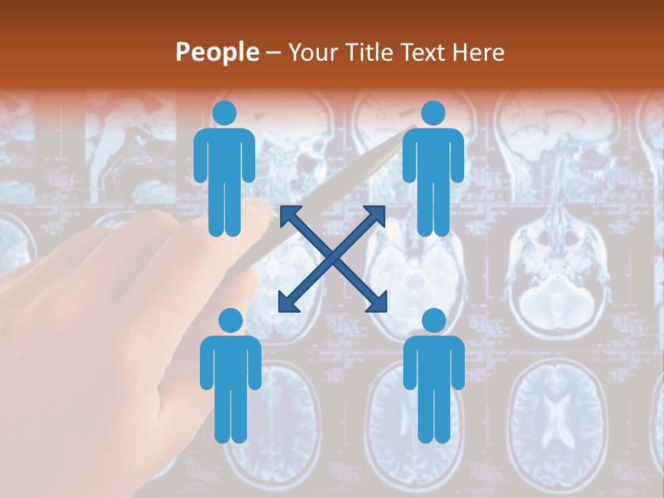 A Person Holding A Pen In Front Of Mri Images PowerPoint Template