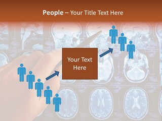 A Person Holding A Pen In Front Of Mri Images PowerPoint Template
