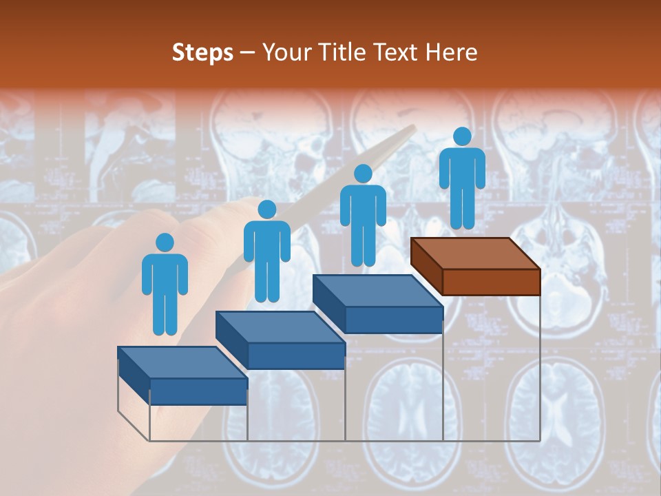 A Person Holding A Pen In Front Of Mri Images PowerPoint Template
