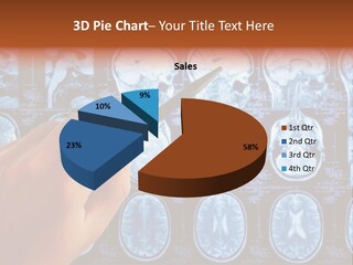 A Person Holding A Pen In Front Of Mri Images PowerPoint Template