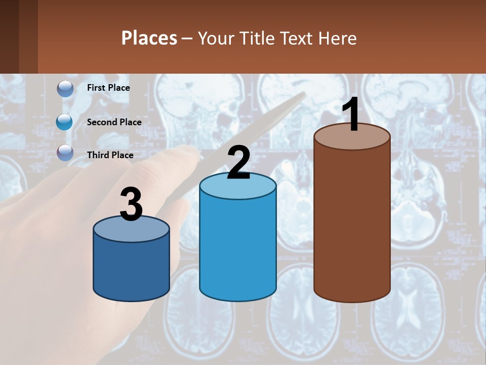 A Person Holding A Pen In Front Of A Brain Scan PowerPoint Template