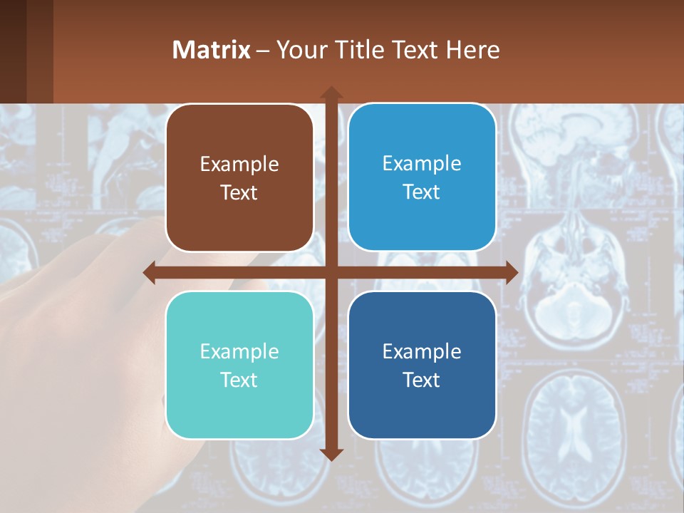 A Person Holding A Pen In Front Of A Brain Scan PowerPoint Template