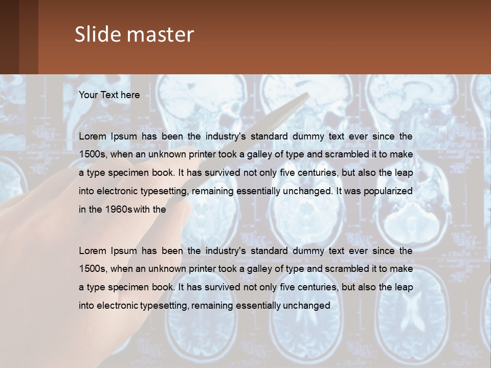 A Person Holding A Pen In Front Of A Brain Scan PowerPoint Template