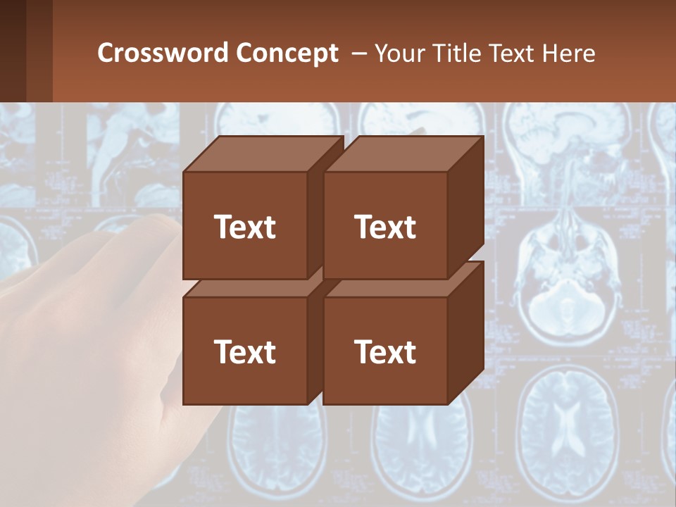 A Person Holding A Pen In Front Of A Brain Scan PowerPoint Template