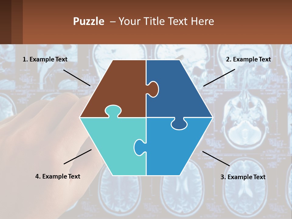 A Person Holding A Pen In Front Of A Brain Scan PowerPoint Template