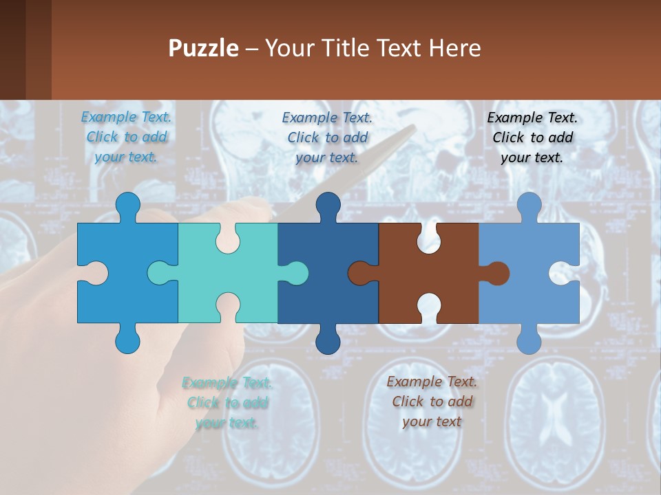 A Person Holding A Pen In Front Of A Brain Scan PowerPoint Template