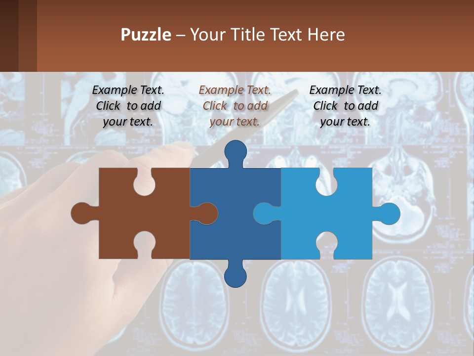 A Person Holding A Pen In Front Of A Brain Scan PowerPoint Template