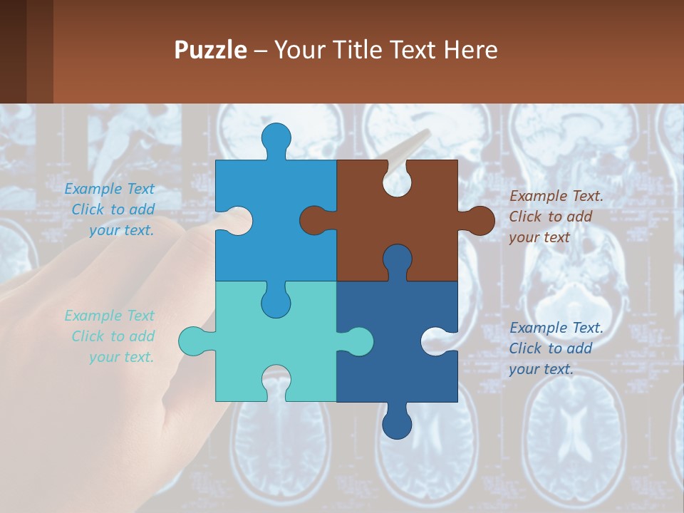 A Person Holding A Pen In Front Of A Brain Scan PowerPoint Template