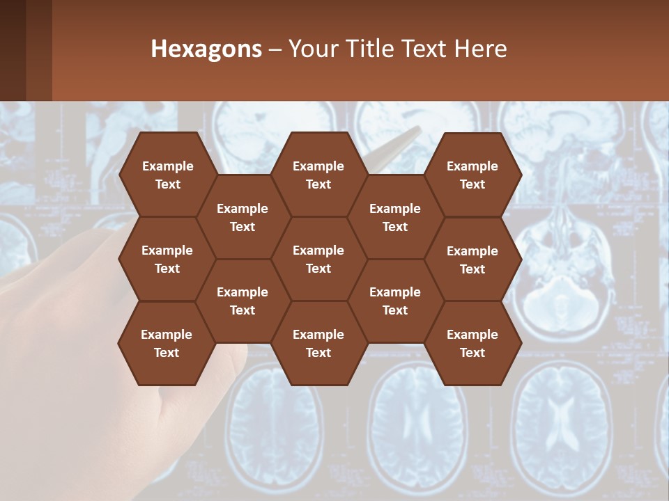 A Person Holding A Pen In Front Of A Brain Scan PowerPoint Template