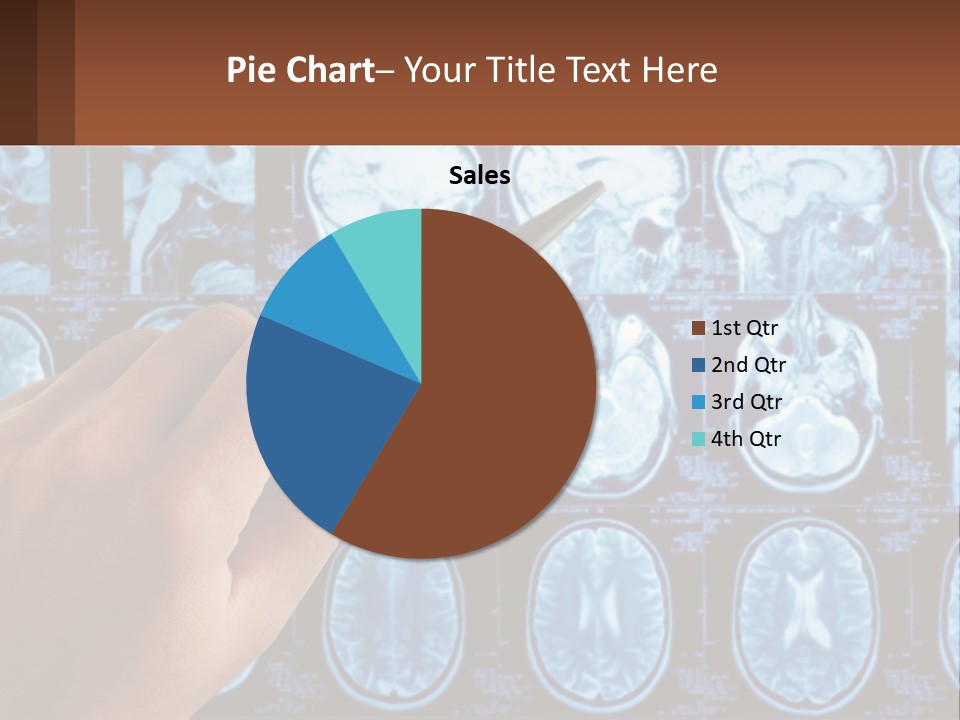 A Person Holding A Pen In Front Of A Brain Scan PowerPoint Template