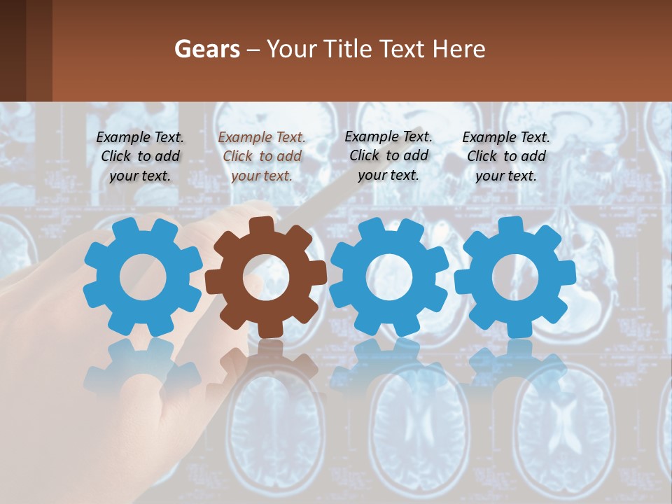 A Person Holding A Pen In Front Of A Brain Scan PowerPoint Template