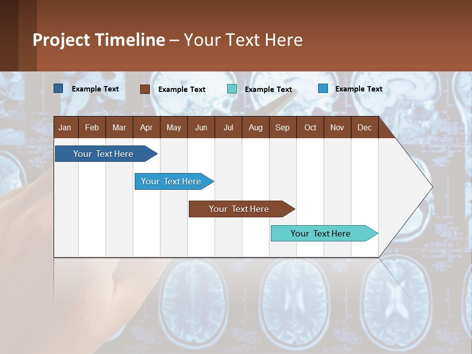 A Person Holding A Pen In Front Of A Brain Scan PowerPoint Template